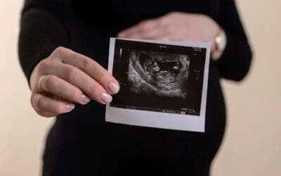 Women’s Maternity Experiences in Scotland Survey